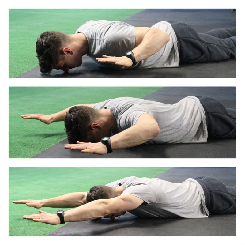 درمان کیفوز