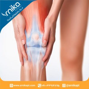 راهکارهای فیزیوتراپی دررفتگی کشکک زانو