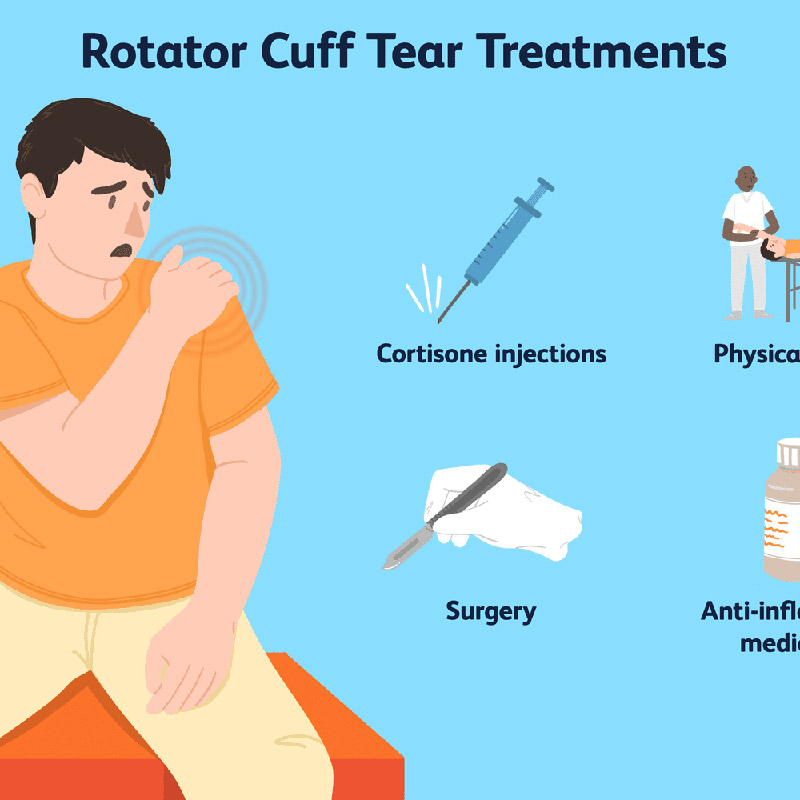 آسیب های روتاتور کاف