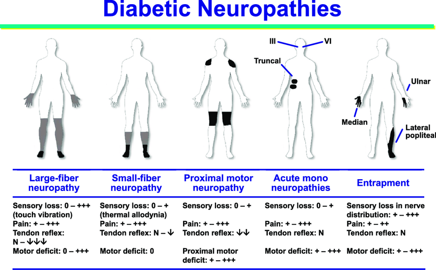 انواع نوروپاتی دیابتی