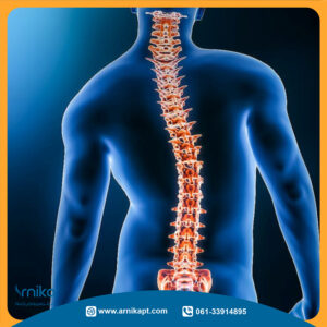 کاربرد فیزیوتراپی برای درمان اسکولیوز در بین مشاغل اداری