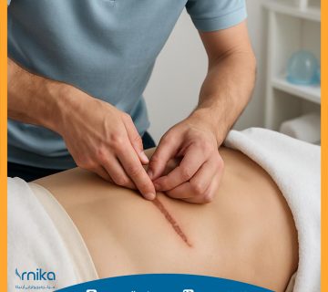 فیزیوتراپی در درمان چسبندگی زخم بعد از عمل جراحی